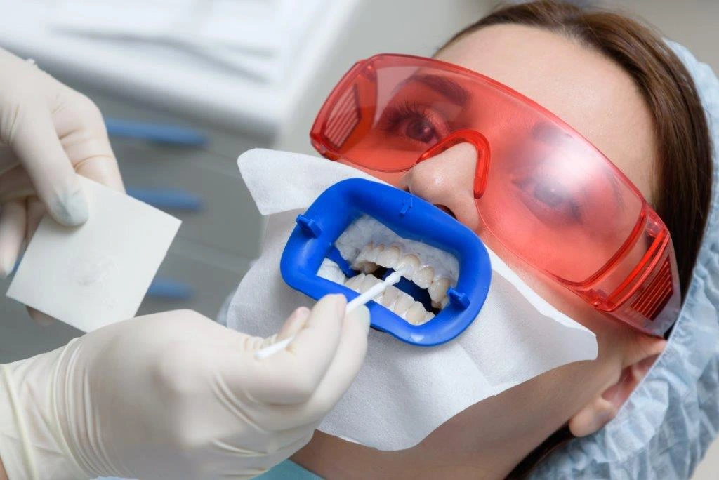Tooth Whitening Tigard