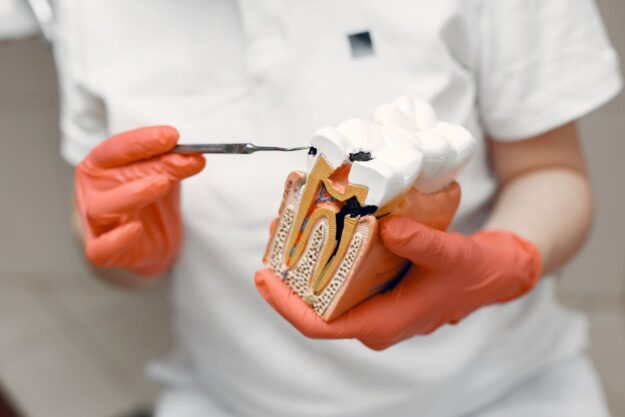 what is a root canal