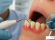 periodontal disease treatment - periodontal disease treatment