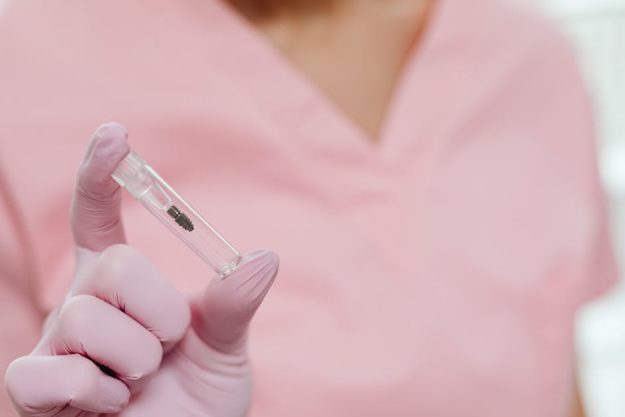 Oregon dental implants
