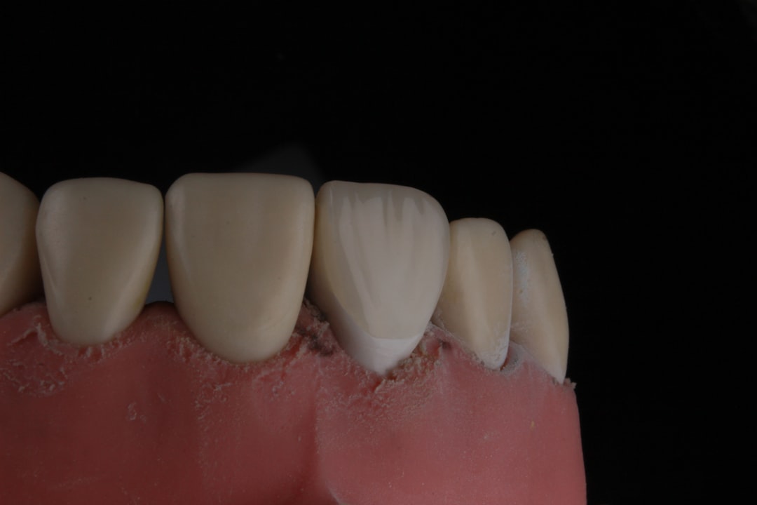 cavity restoration