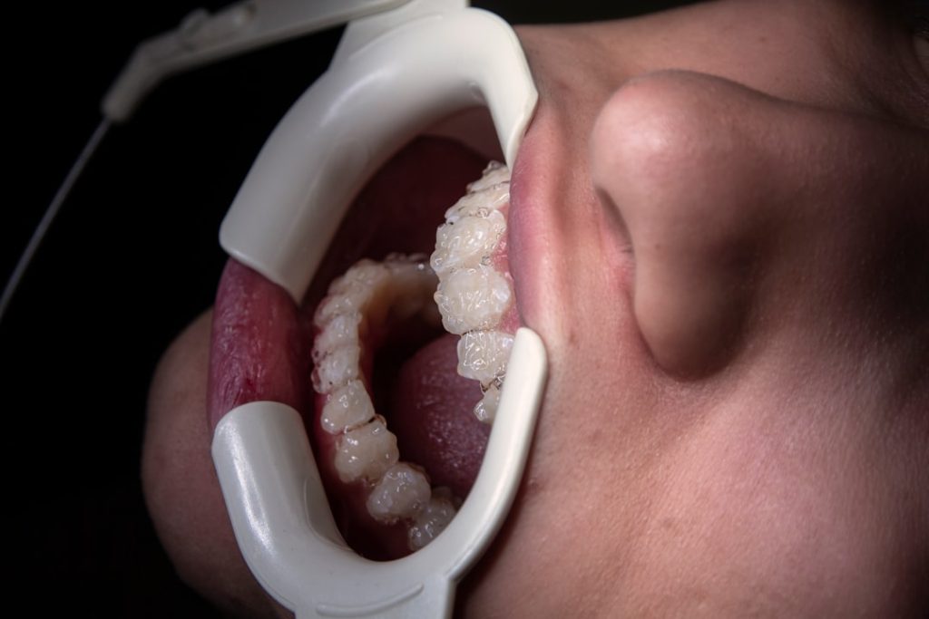 gum disease treatment