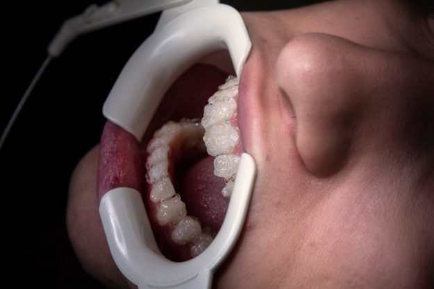 gum disease treatment