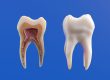 how to restore cavity naturally