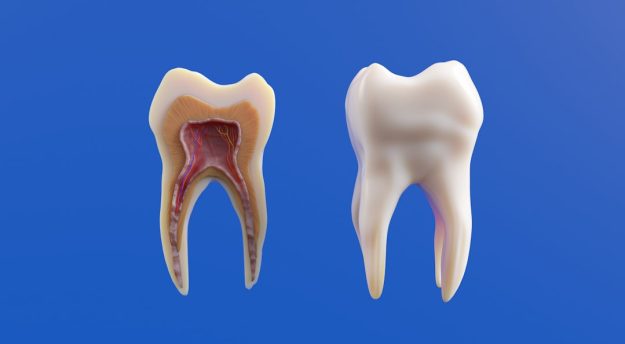 how to restore cavity naturally