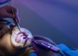 Orthodontic treatment options