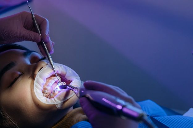 Orthodontic treatment options