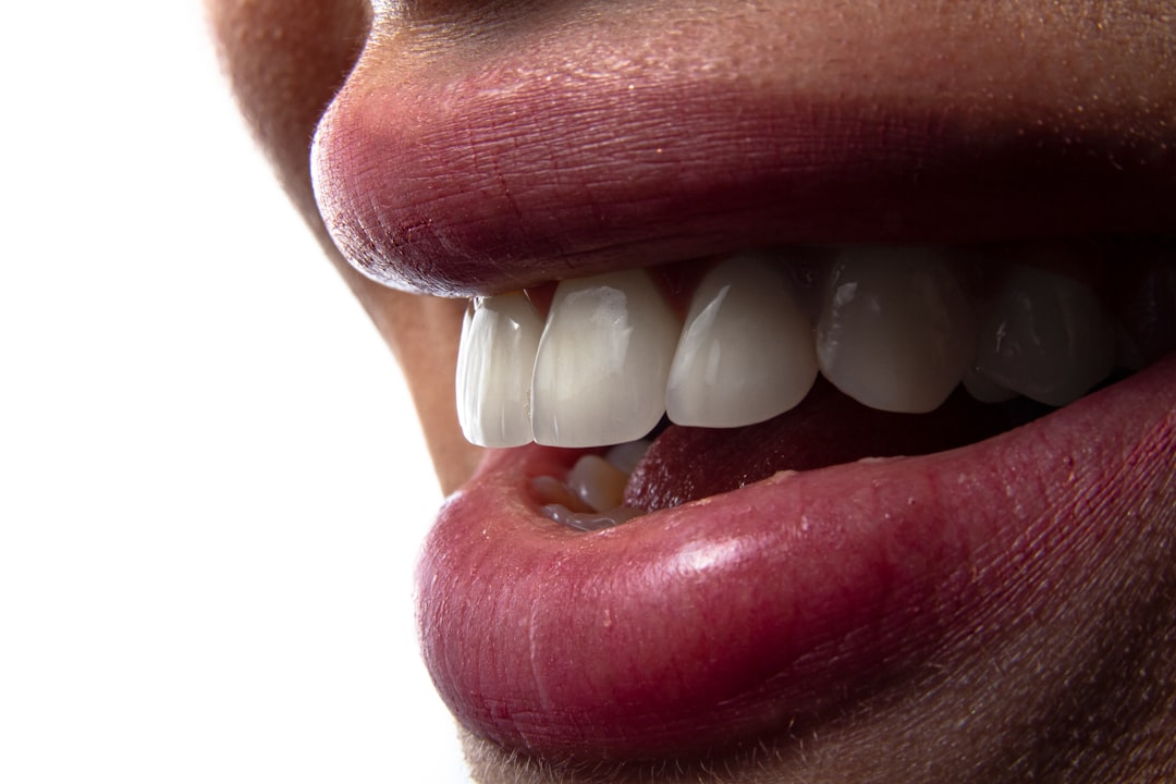 gum cavity home remedies